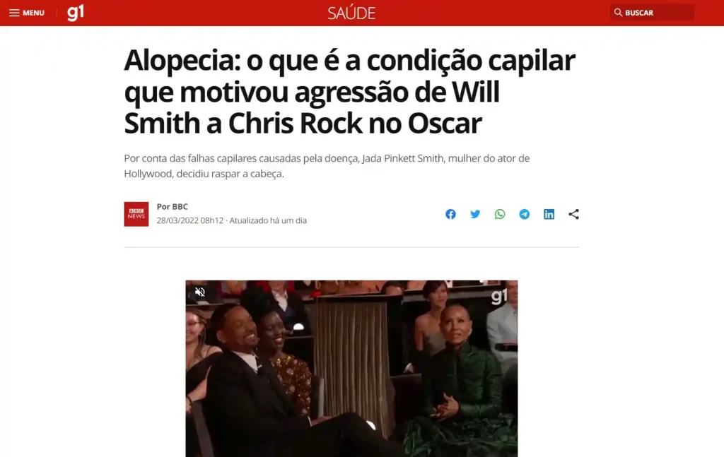 Alopecia Will Smith no Oscar